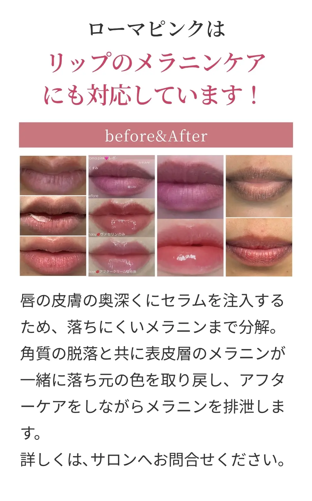 Before&After