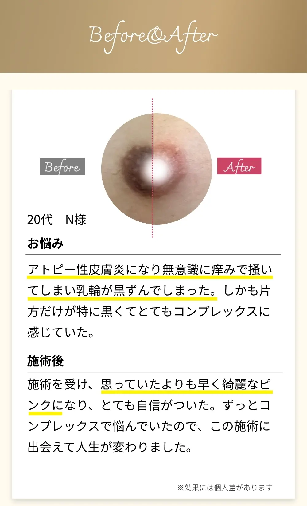 Before&After