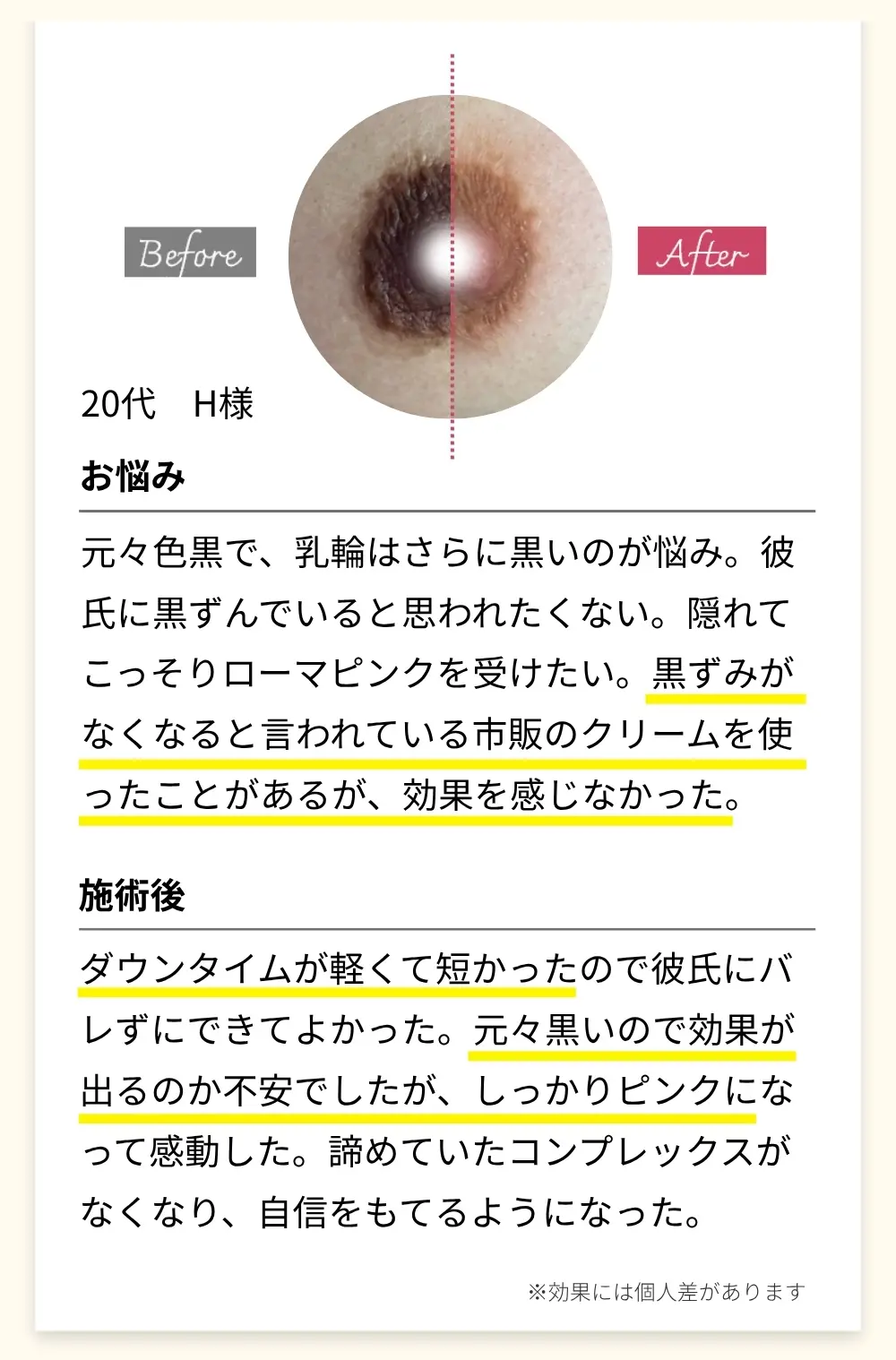Before&After